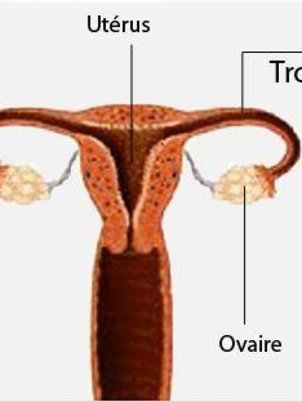 Uterus femme 2